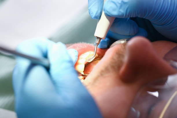 Best Cracked Tooth Emergency Dentist  in Gonzales, TX